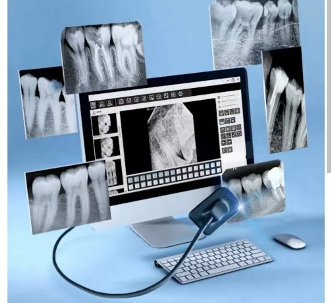 Digital X-Ray System